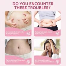 Yurhersu Pregnancy Cream Art.9799  Укрепляющий крем от растяжек,100гр
